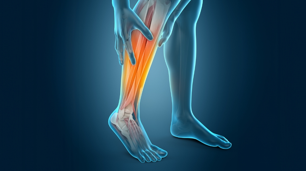 하퇴근육의 긴장