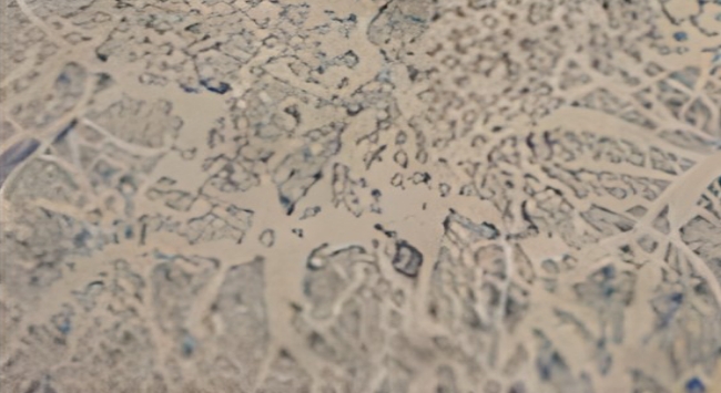 한약 투여 쥐 신경세포