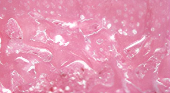 정상 쥐 연골세포