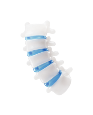 척추가 휘어진 형태를 표현한 척추 3D 이미지